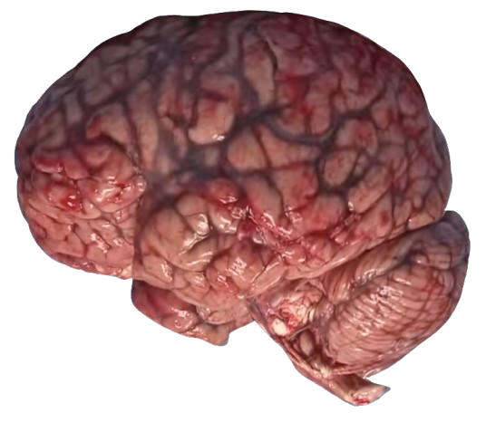 Brain