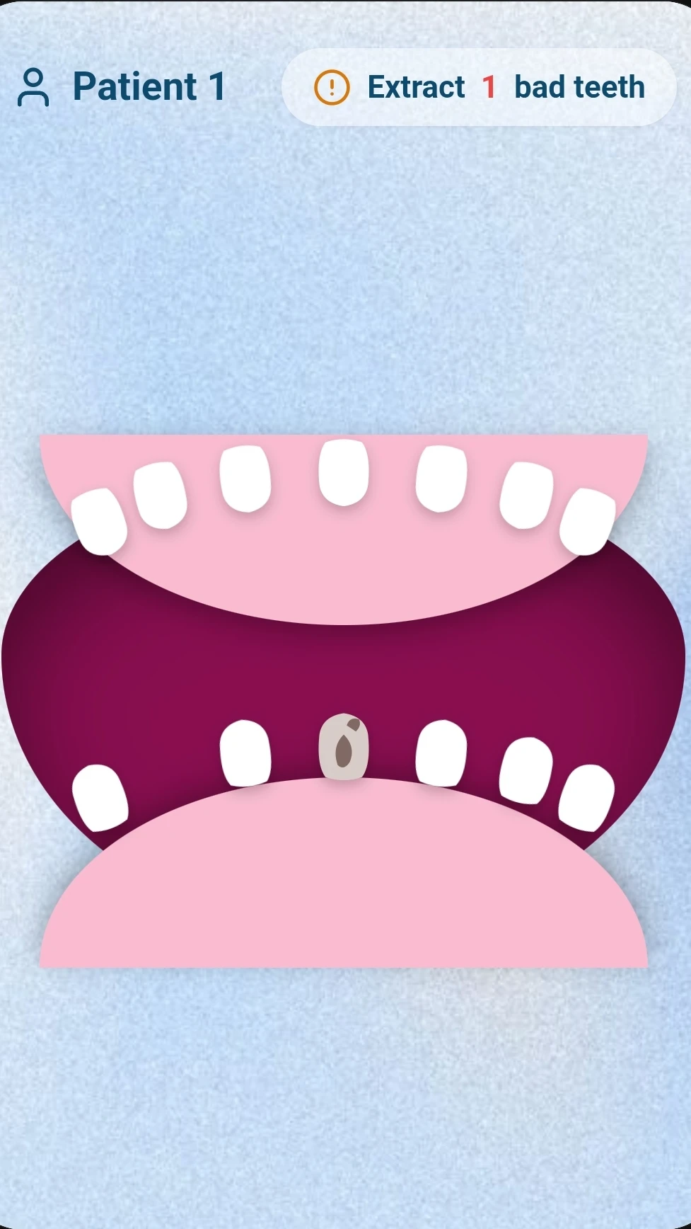 Dental Clean #teethCleaning
