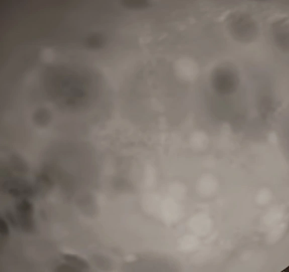 ball texture 4