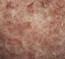 ball texture 7
