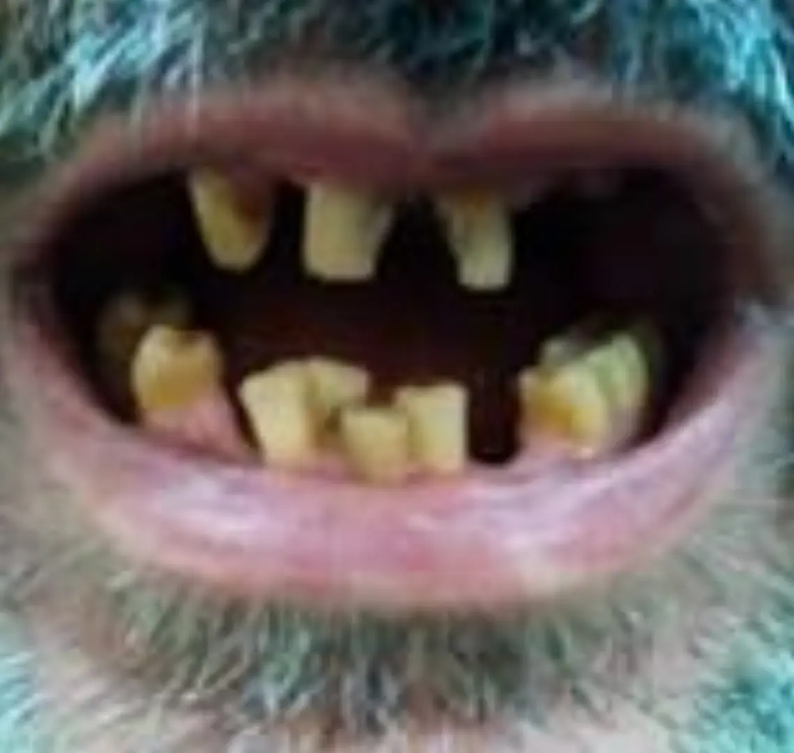 Glossy Smile Dental Clinic cover