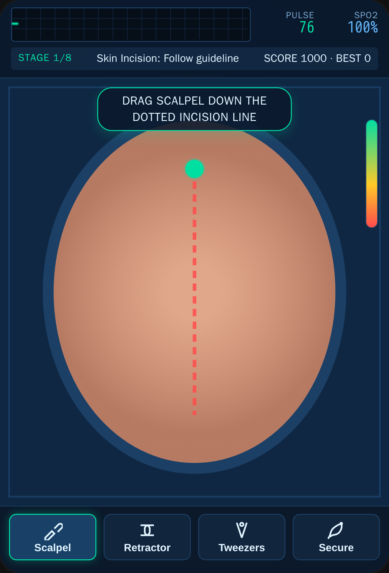 Cardiothoracic Surgery Simulator cover
