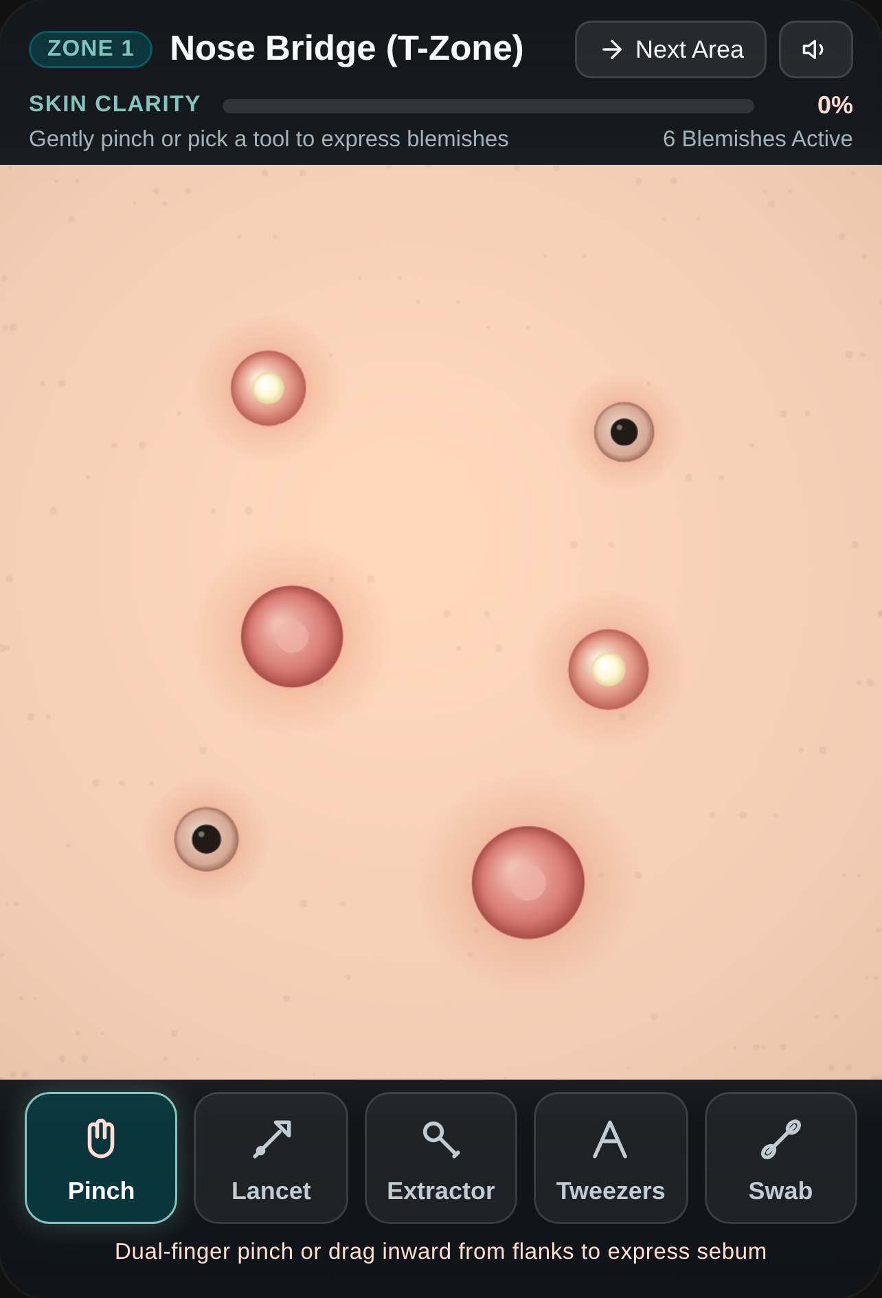 Zen Dermatology - Skin Extraction cover
